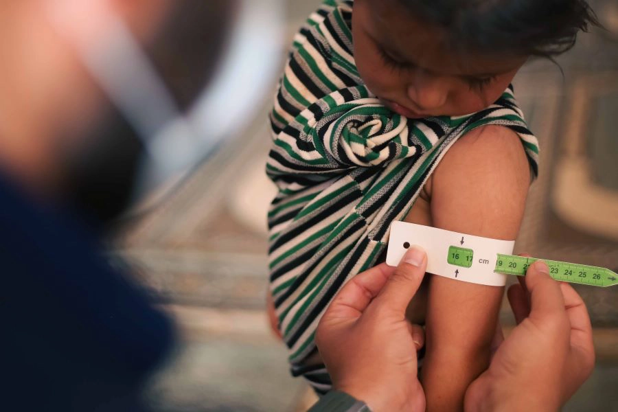 doctor examines children's malnutrition inside a refugee camp using a mid-upper arm circumference belt